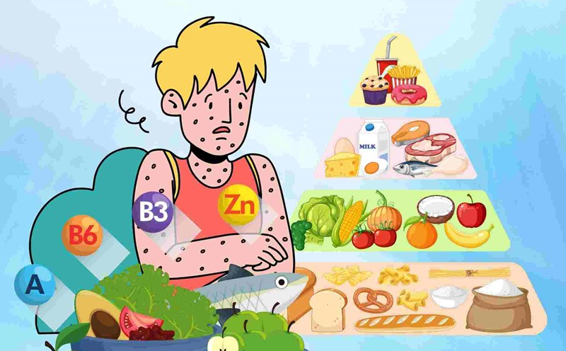 Nutrition helps measles patients recover quickly