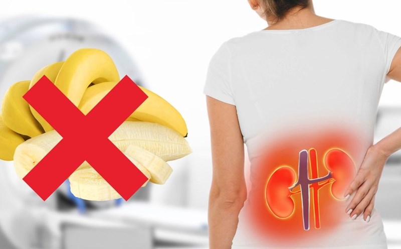 Reasons why people with chronic kidney disease should not eat bananas and water spinach