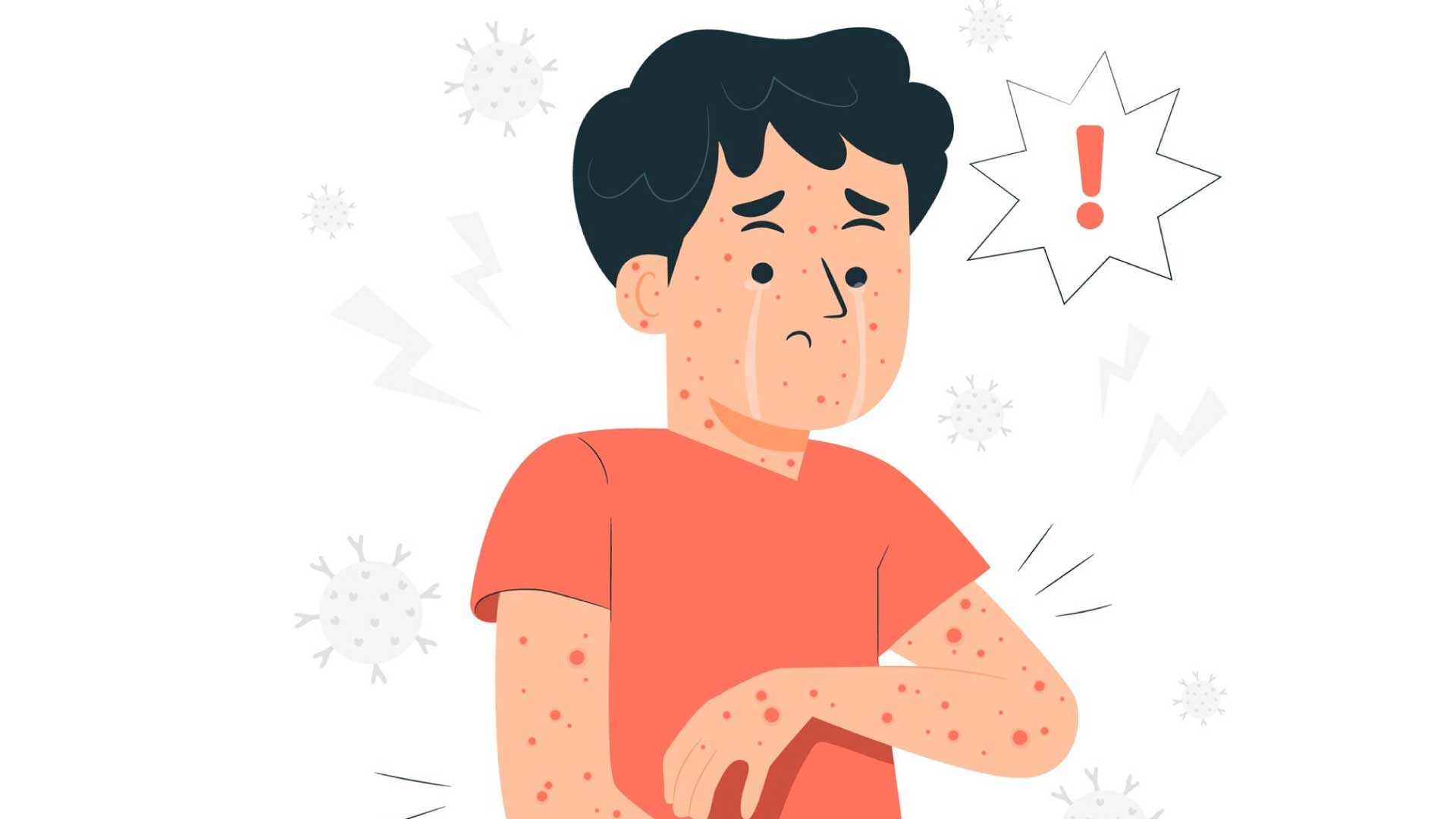 How to distinguish between allergic dermatitis and contact dermatitis. Graphics: Thien Nhan