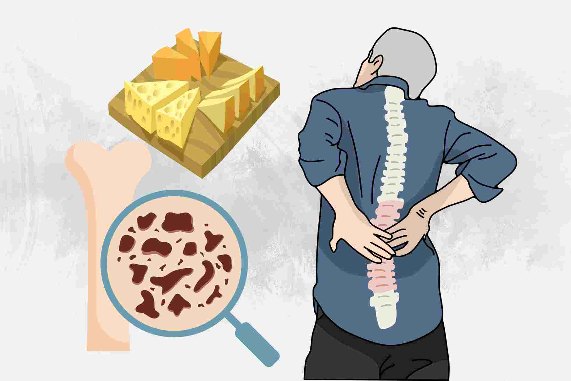 Top 3 Snacks That Prevent osteoporosis. Graphics: Dinh Dinh