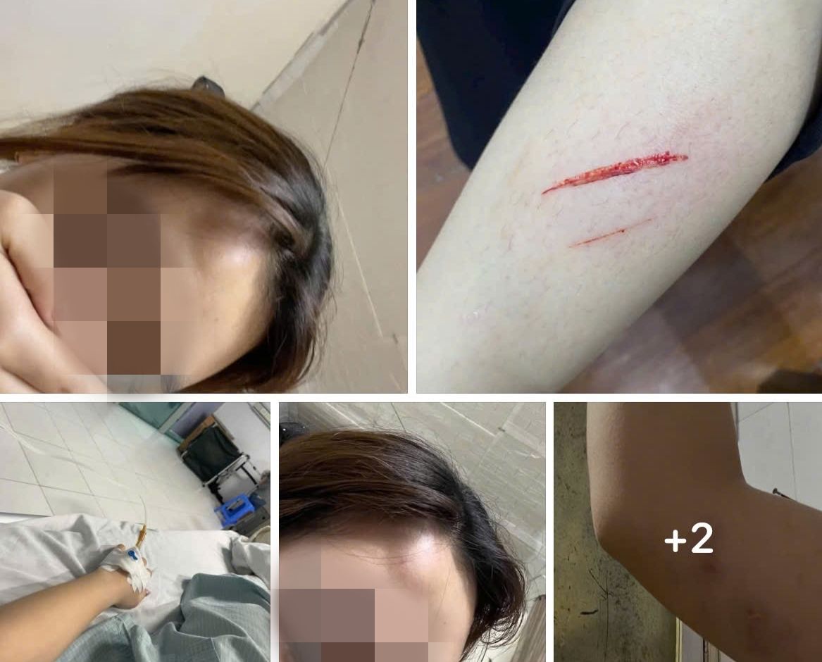 Công an phường Yên Hòa, quận Cầu Giấy đang xác minh thông tin liên quan đến vụ việc một nữ sinh viên đi làm thêm tố cáo bị đồng nghiệp hành hung chỉ vì tiền bo của khách. Ảnh chụp màn hình