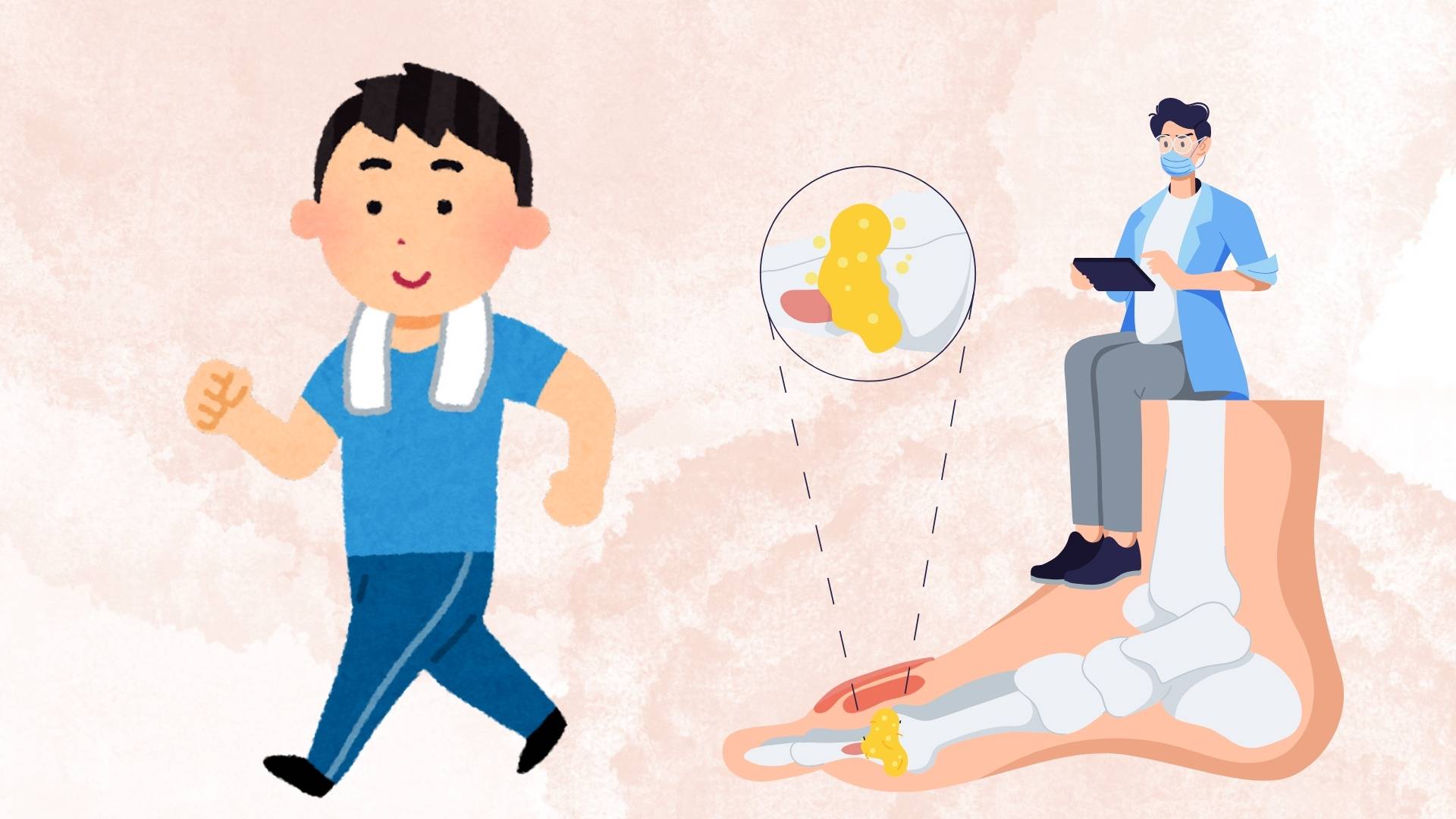 Como caminar con gota