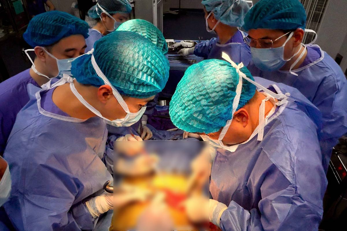 Realizo un trasplante de riñon en el Hospital General de la Provincia de Quang Ninh. Imagen de la CDC de Guangming