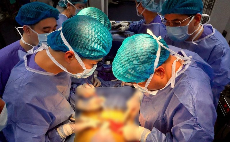 Performing a kidney transplant at Quang Ninh General Hospital. Photo: CDC Quang Ninh