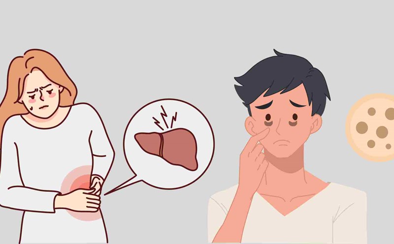 Some signs of poor liver detoxification. Graphics: Ha May