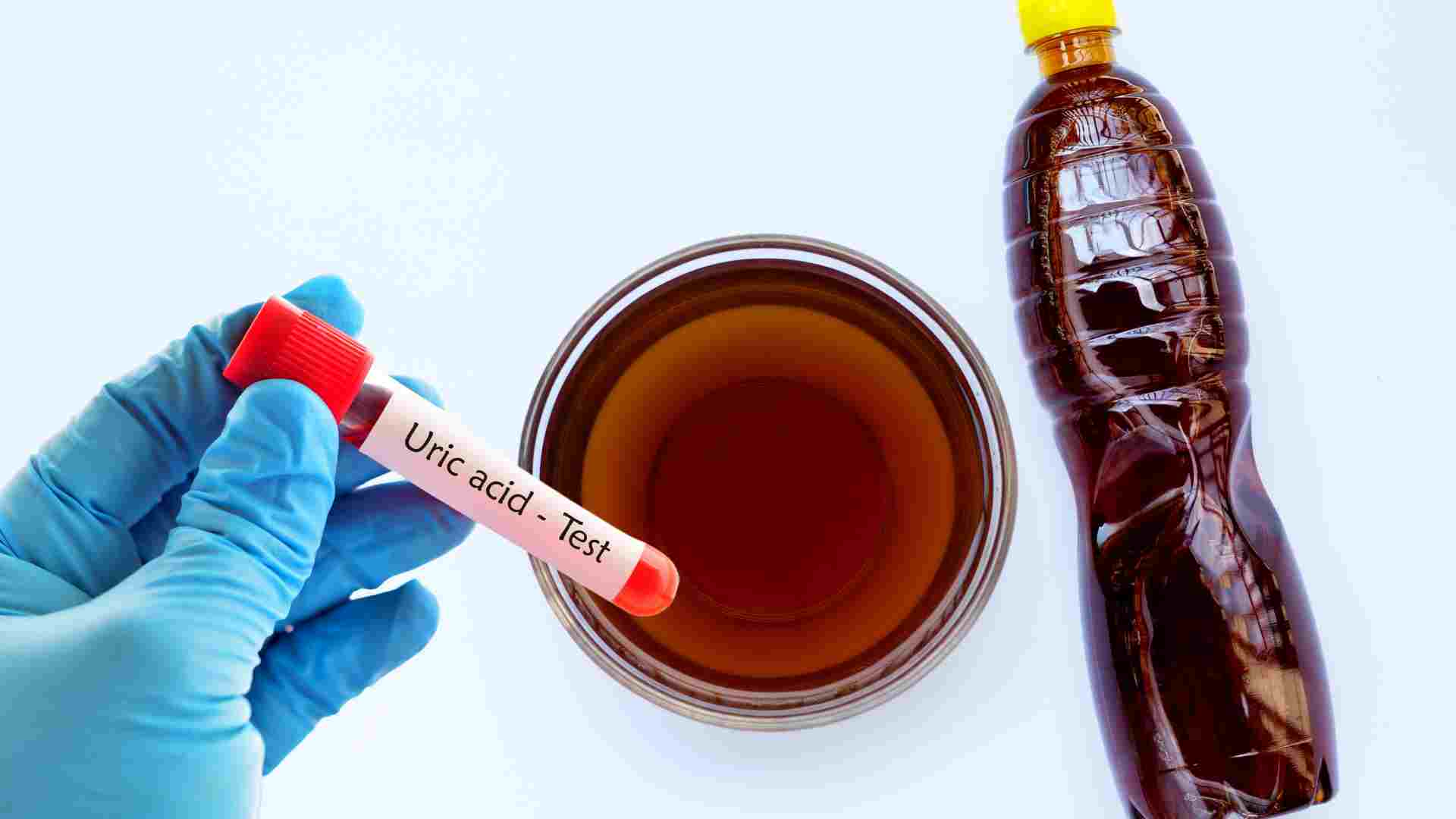 La salsa de pescado puede hacer que el acido urico aumente. Graficos: nubes inferiores