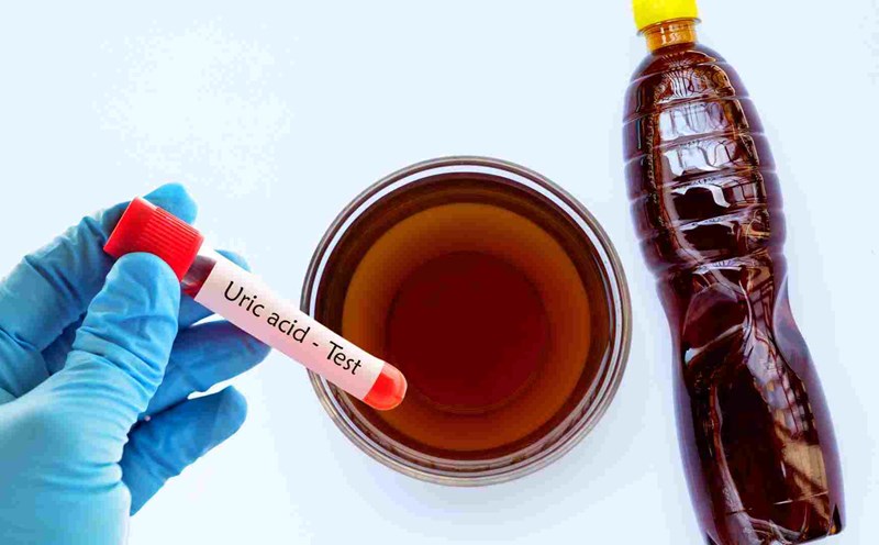fish sauce can cause uric acid to increase. Graphics: Ha May