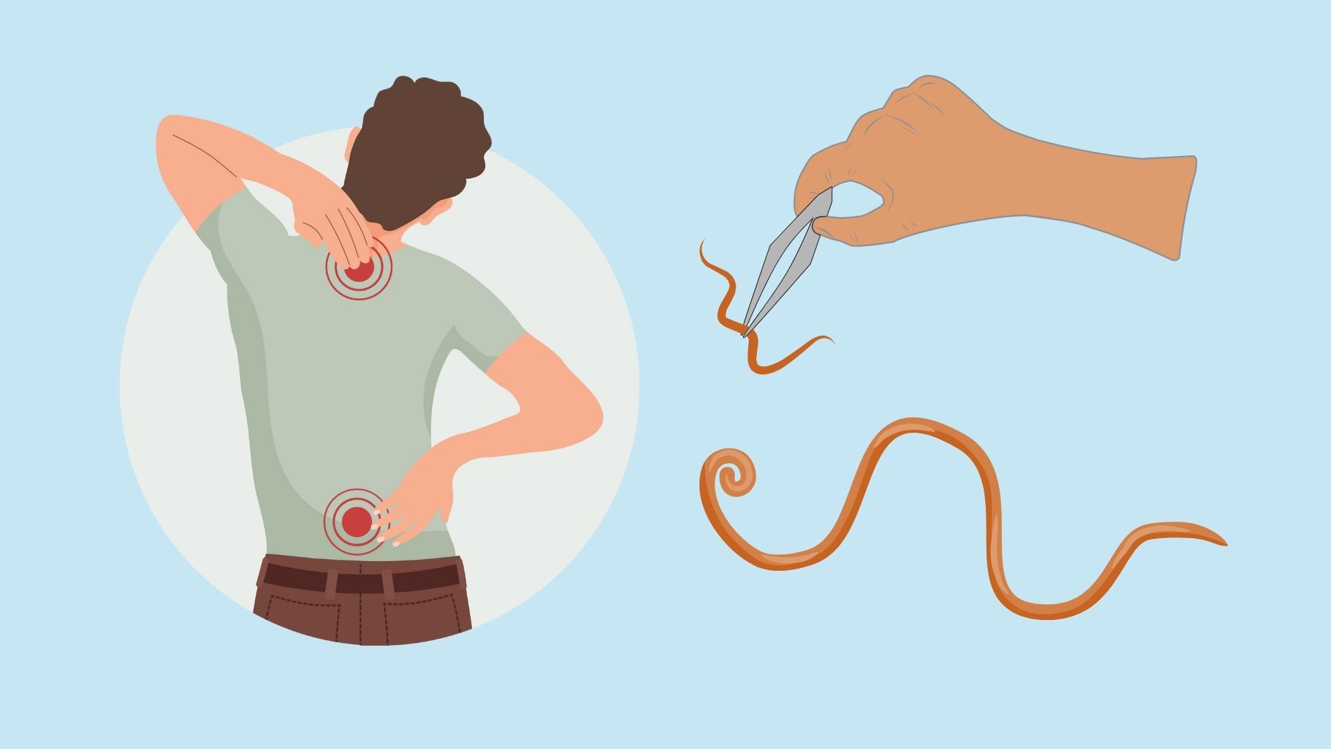 Los gusanos permanecen en el cuerpo durante un año. Diseñado por Linh Dan