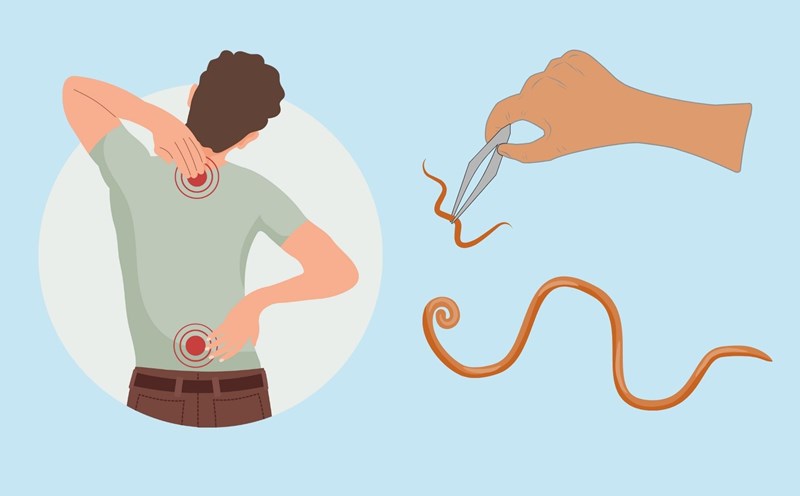 Dragon worms silently exist in the body all year round. Graphics: Linh Dan