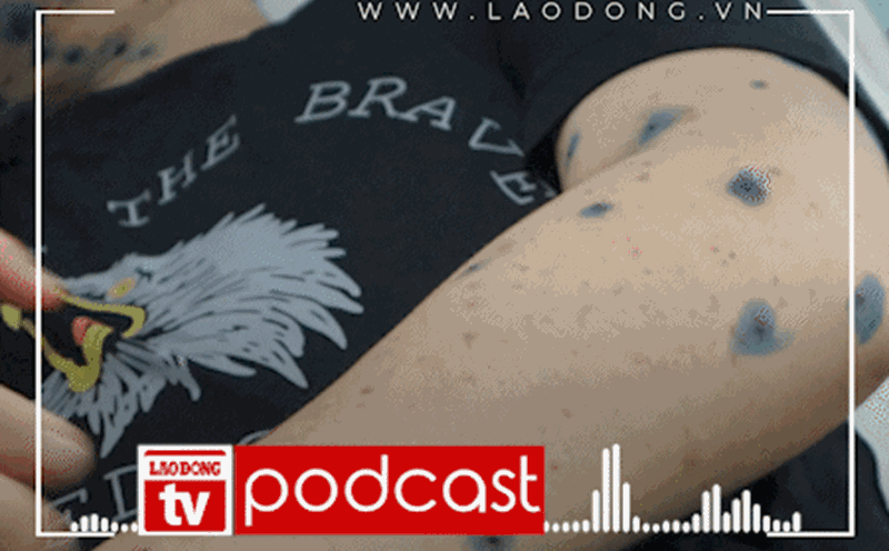 PODCAST: Bean sprouts attack young children, doctors predict effective treatment