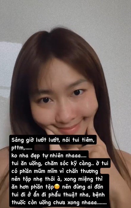 Kha Ngan khang dinh khong phau thuat tham my. Anh: Nghe si cung cap