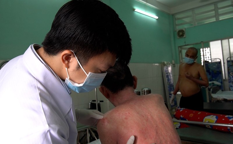A patient with chronic secretive dermatitis had to be hospitalized for treatment. Photo: NGUYEN LY