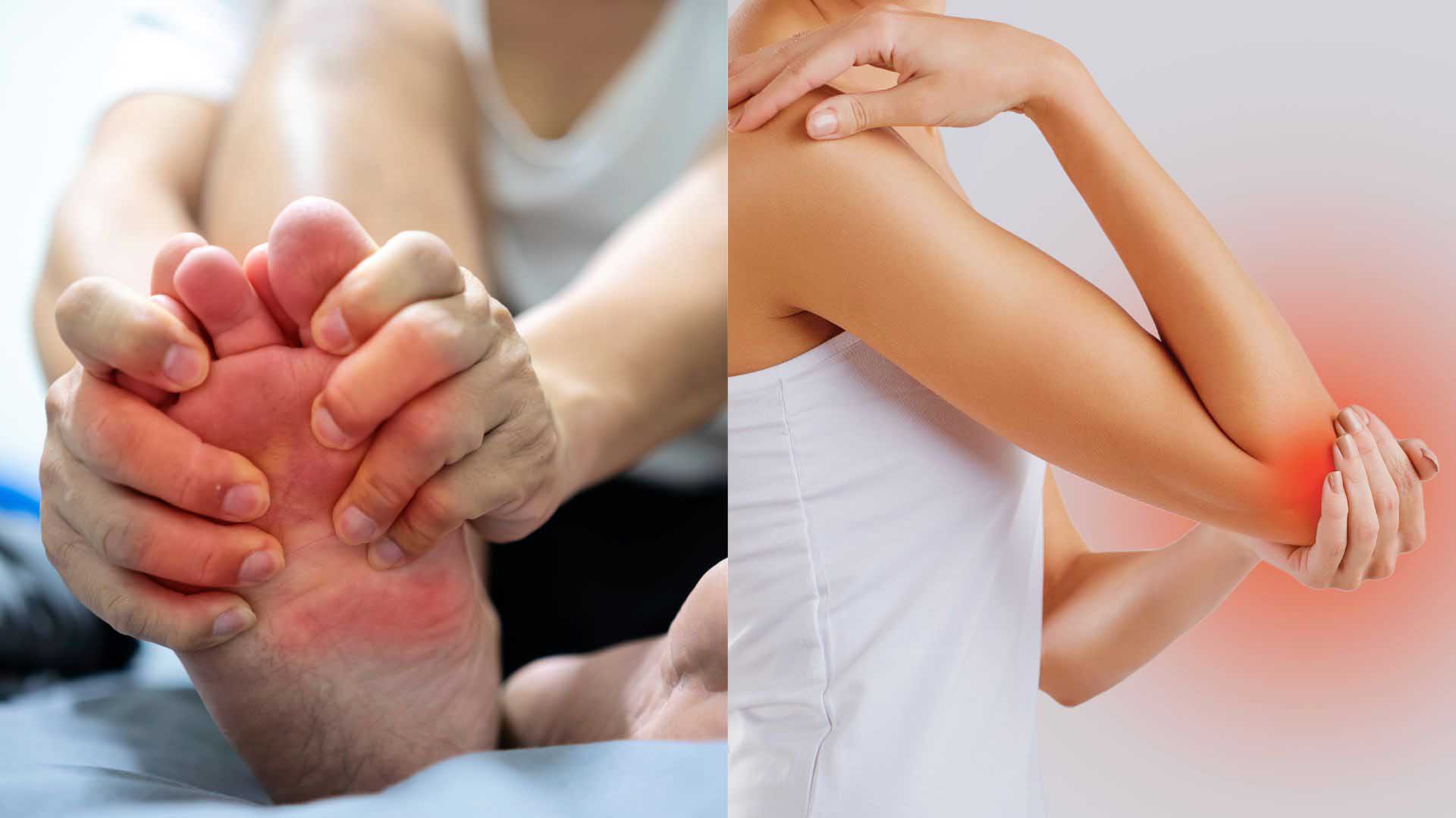 El verano no causa directamente el aumento de acido urico, pero el clima extremo puede ser un catalizador peligroso para las personas con alto riesgo. El dibujo: