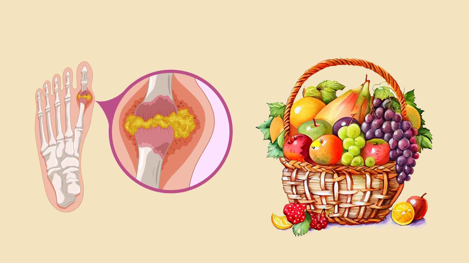 Resiste el acido urico alto gracias a las frutas conocidas que son ricas en vitamina B12. Diseño y dibujo:
