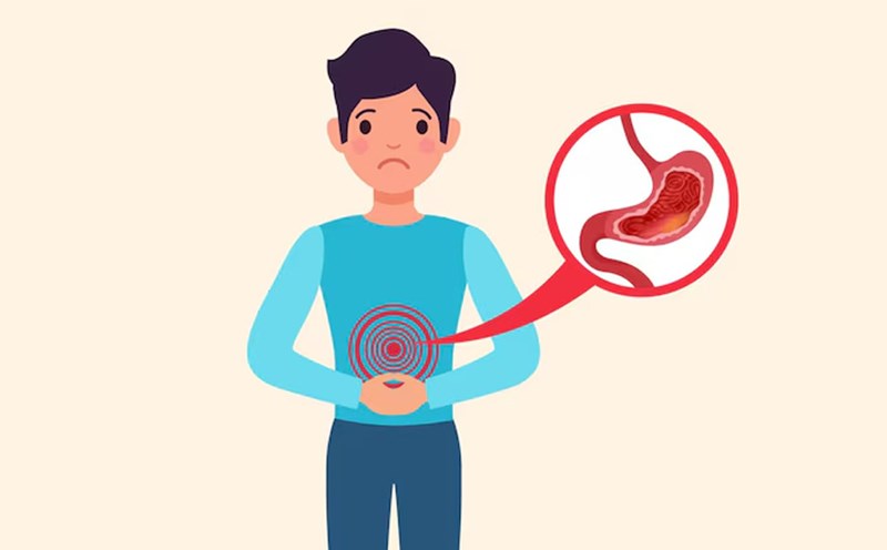 Intermittent fasting can help reduce acid reflux symptoms. Graphics: Thien Nhan