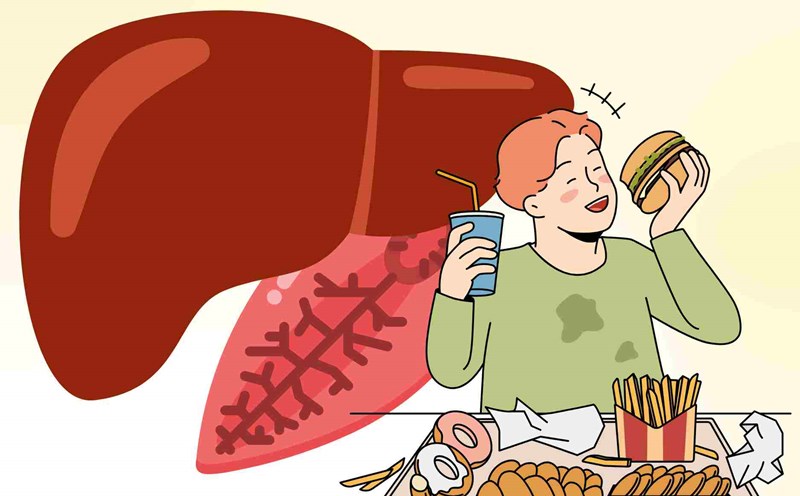 Warning about the stage of proving liver dysfunction from eating habits