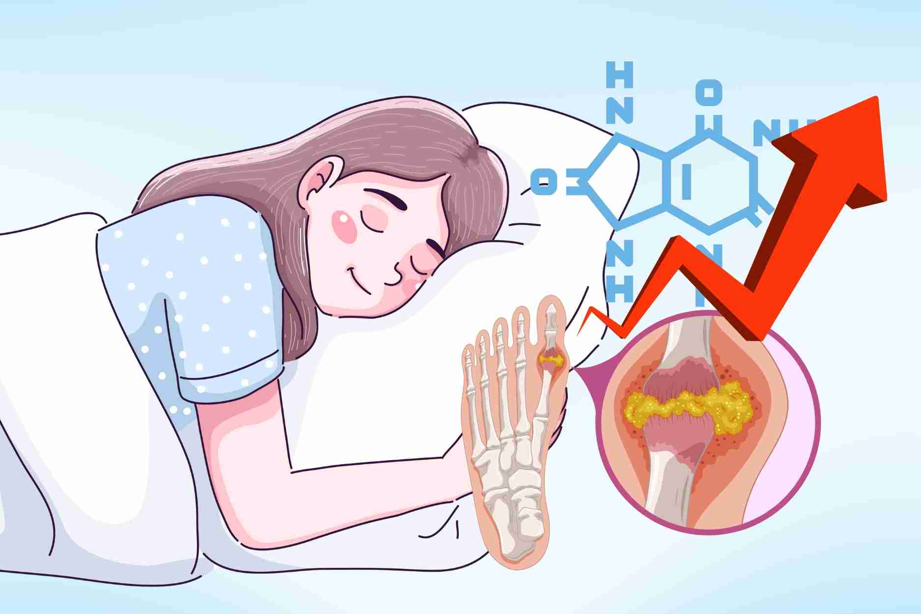 El sueño aparentemente inofensivo es el culpable oculto de la elevacion del acido urico. El dibujo: