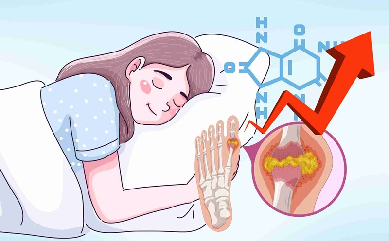 Sleep that seems harmless is the silent culprit of increasing uric acid. Graphics: Dinh Dinh