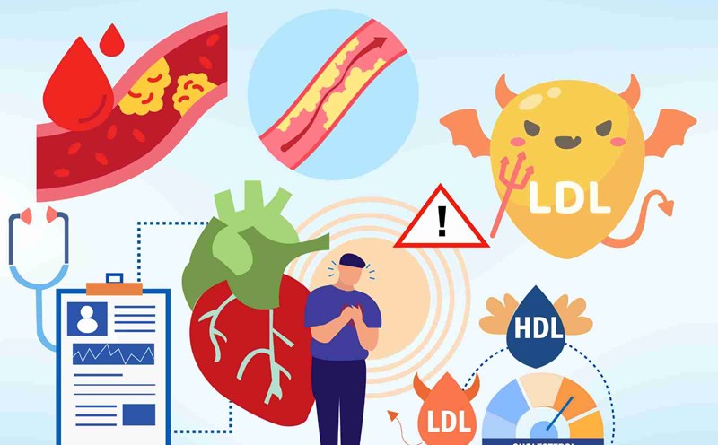 High cholesterol and warning signs of dyslipidemia