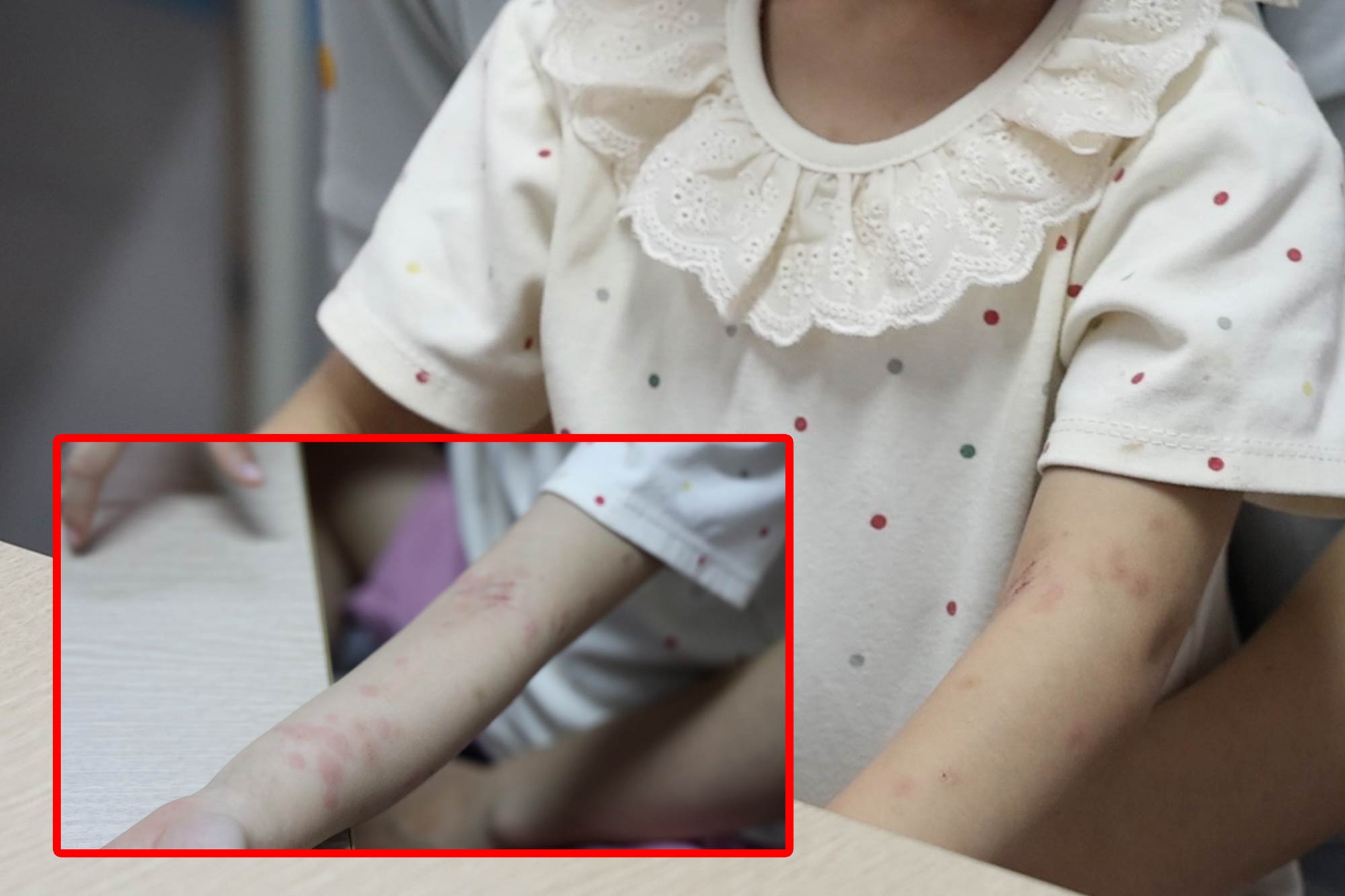 Picah fichas Debido a perros y pulgas de gato, Peters necesita hacer esto