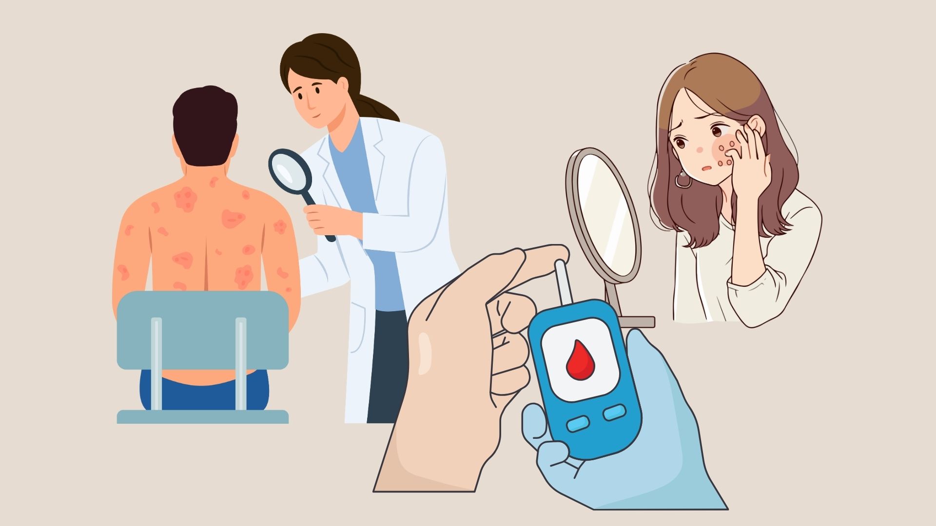 Alto azucar en la sangre, la piel es facilmente espinillas de brote. Grafico: Linh Dan