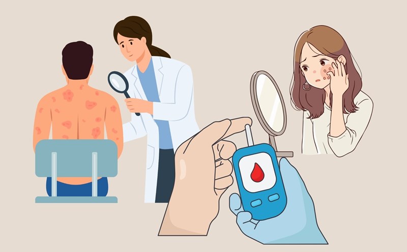 High blood sugar, skin is prone to boils. Graphics: Linh Dan