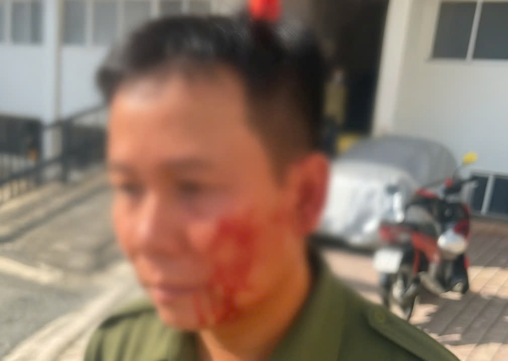Trong qua trinh khong che doi tuong, mot thanh vien cua luc luong an ninh trat tu (ANTT) da bi thuong. Anh: Dong Hoang