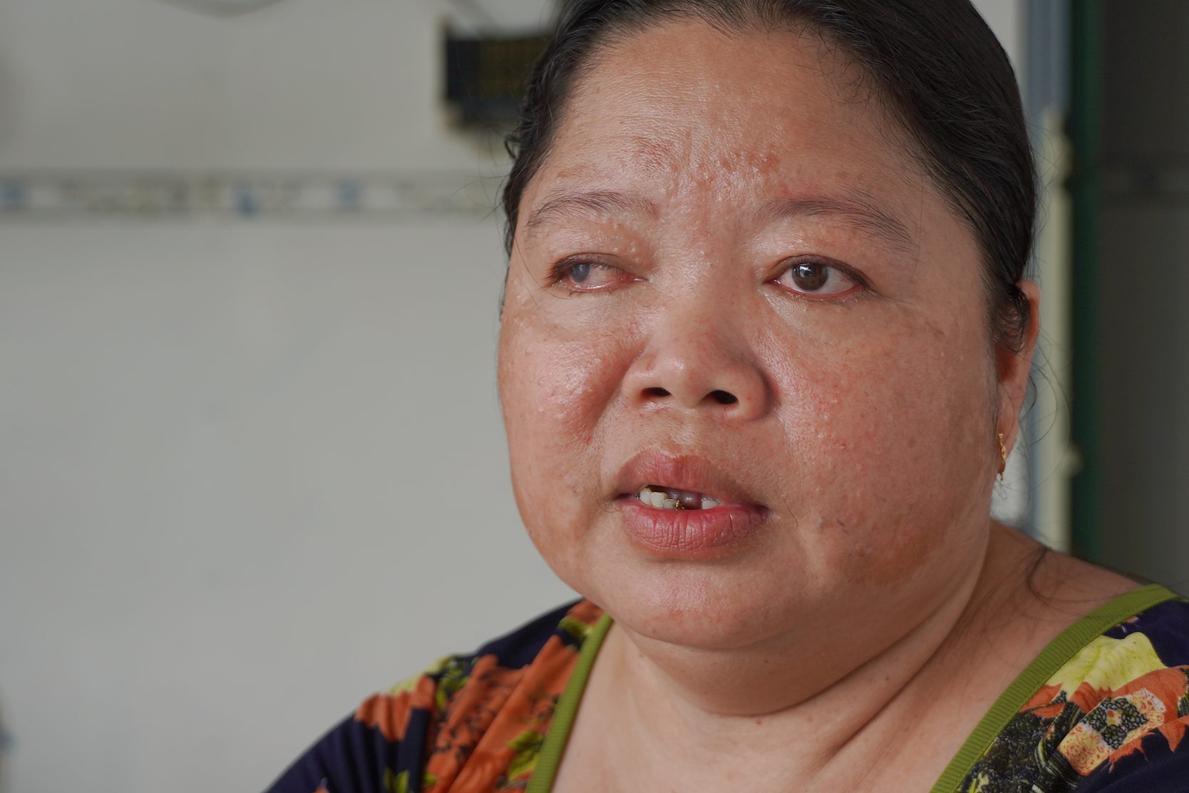 Chi Huynh Kim Su (47 tuoi) van con run ray khi ke lai su viec. Anh: Ta Quang