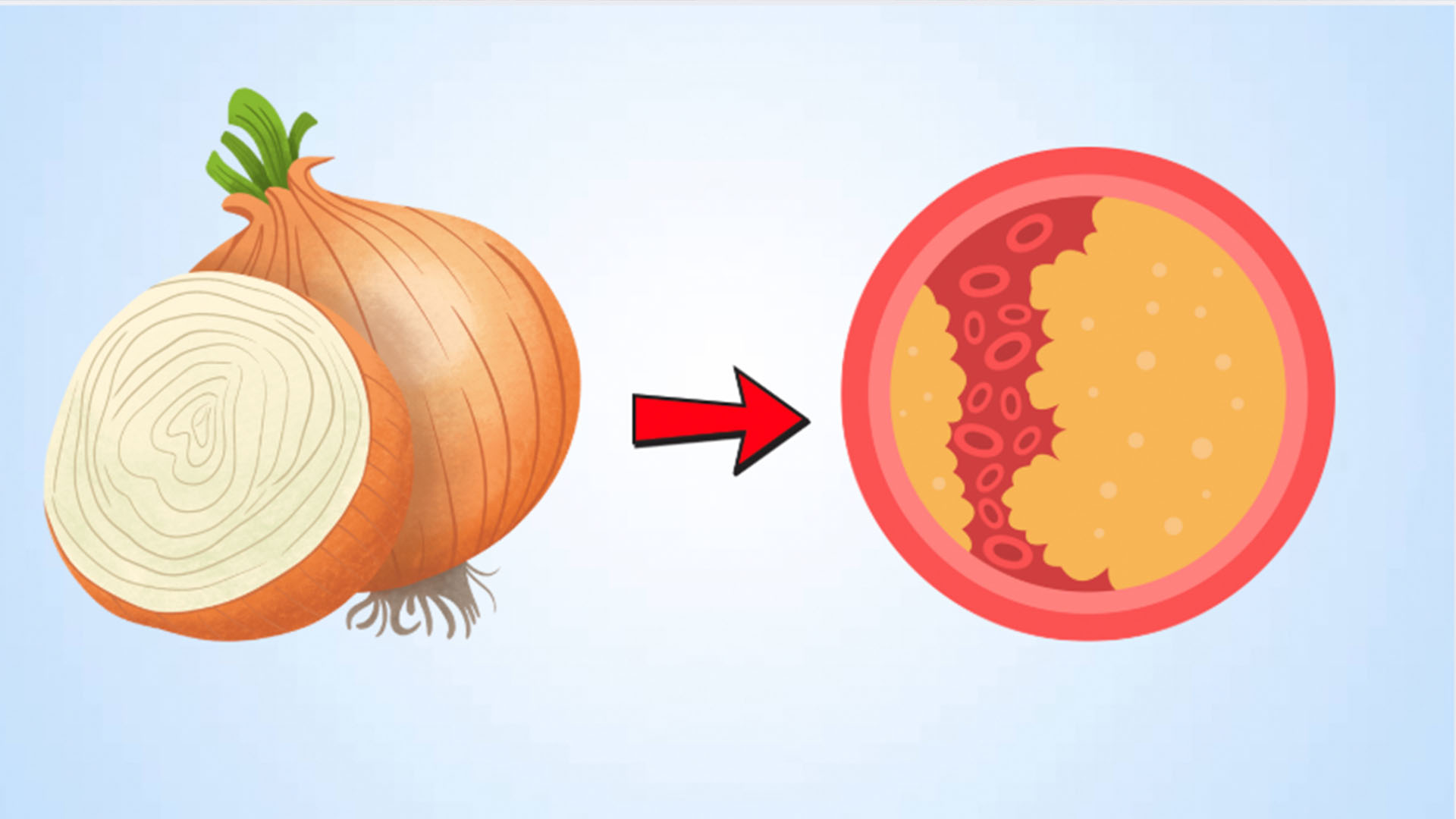 Como comer cebollas reduce la grasa en la sangre