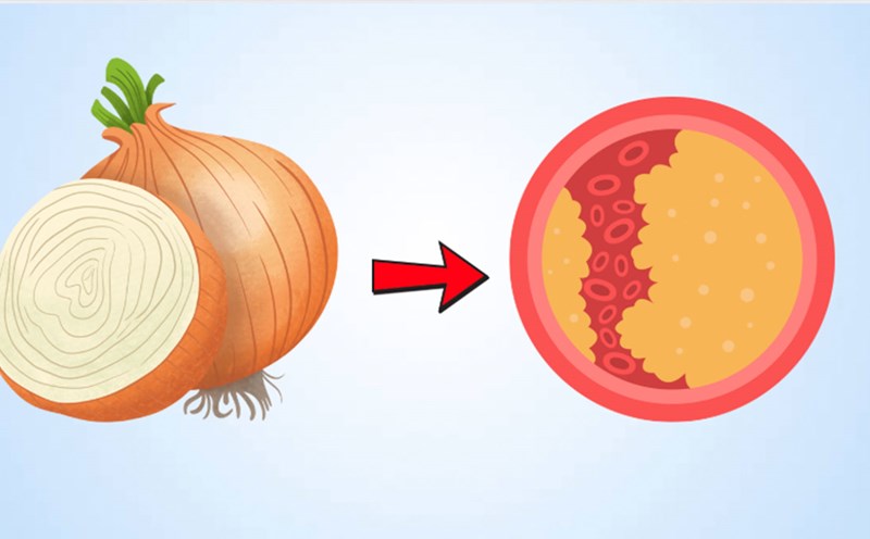 How to eat onions to reduce blood fat