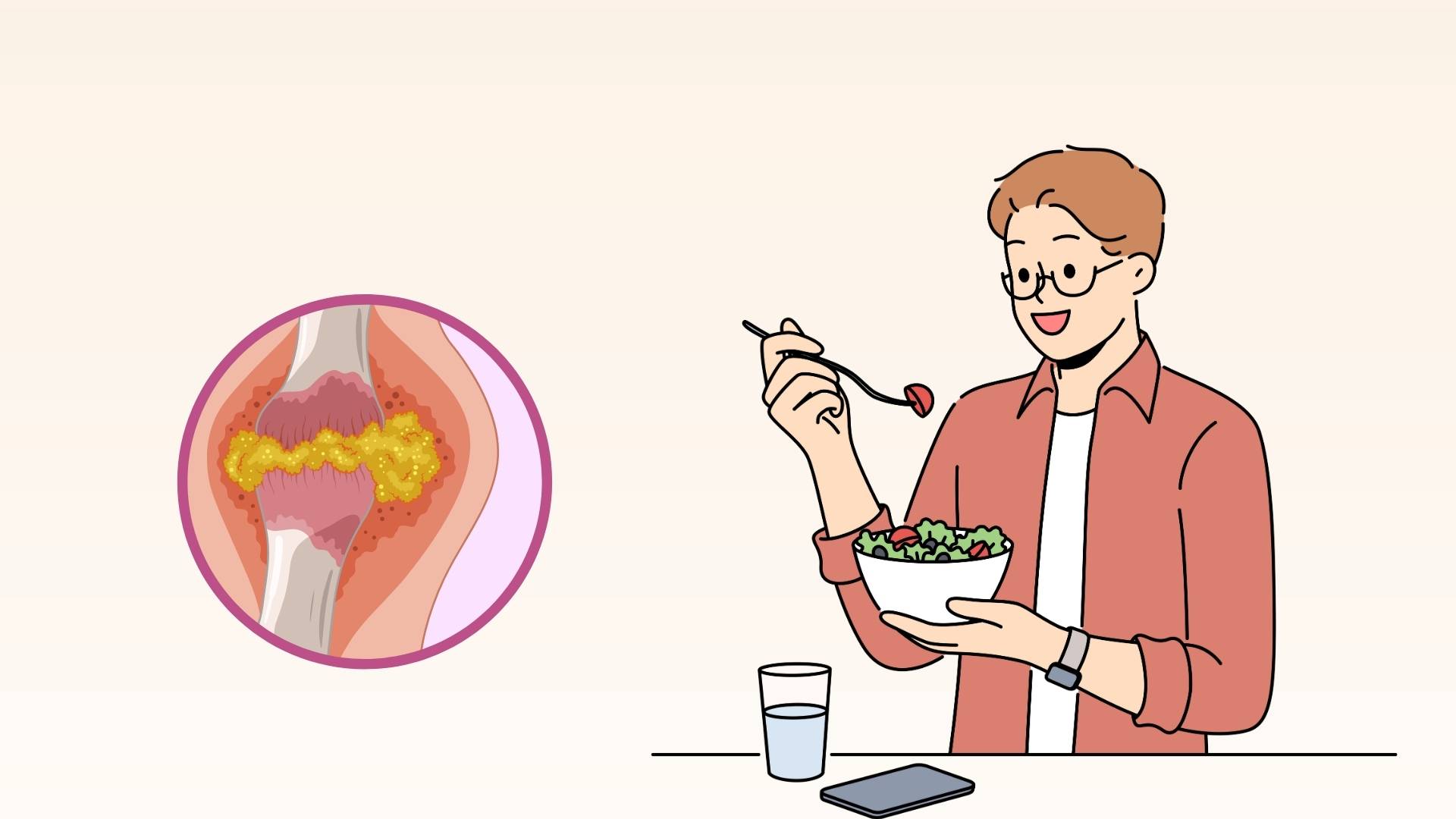 Avoid these foods on the rice tray because they can increase uric acid. Graphics: Minh Chau