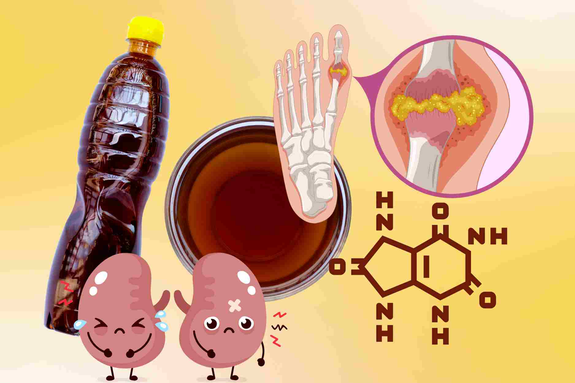 La razon para comer mucha salsa de pescado es facil de disparar la concentracion de acido urico