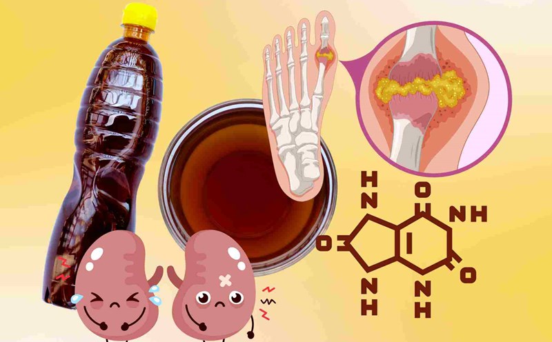 Reasons why eating a lot of fish sauce can easily cause uric acid levels to spike