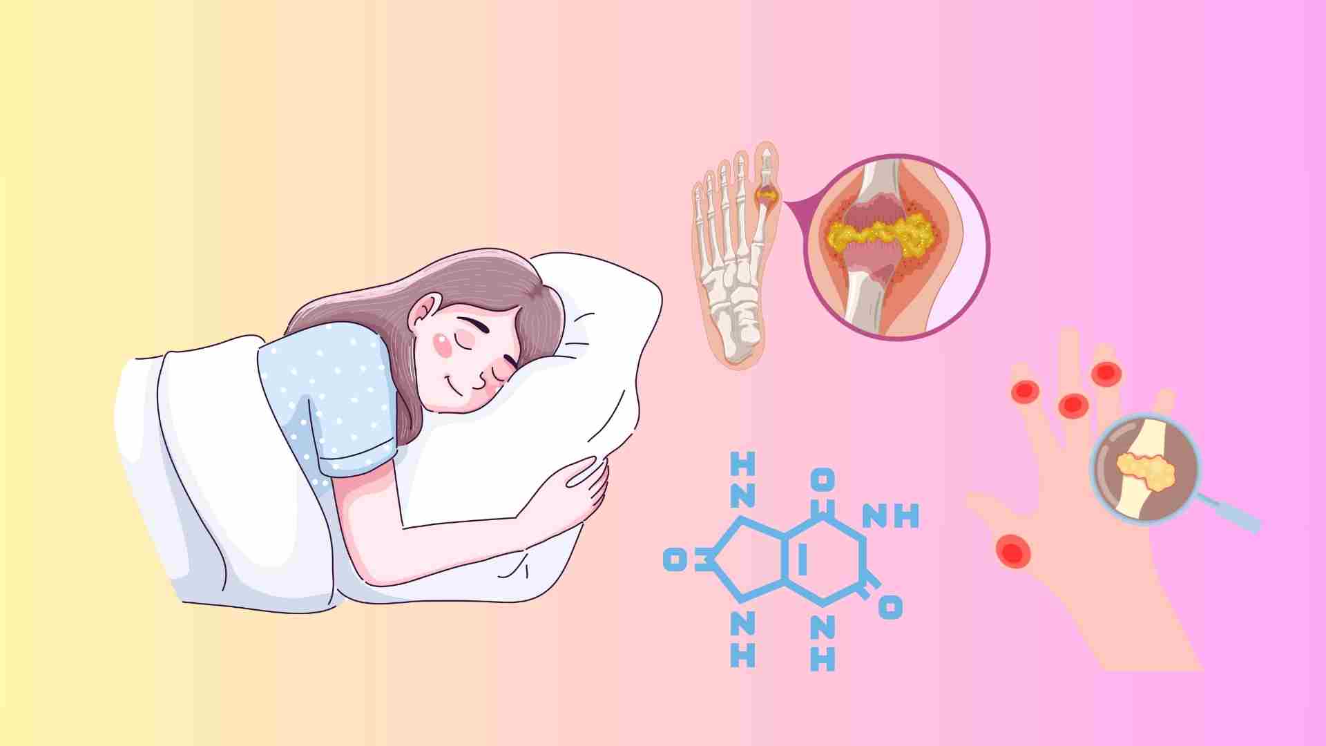 Dormir en la postura equivocada puede empeorar la gota, especialmente por la noche. ¿Entonces las personas con alta concentracion de acido urico deberian estar mintiendo mejor y menos dolorosas? Graficos: Huyen Trang