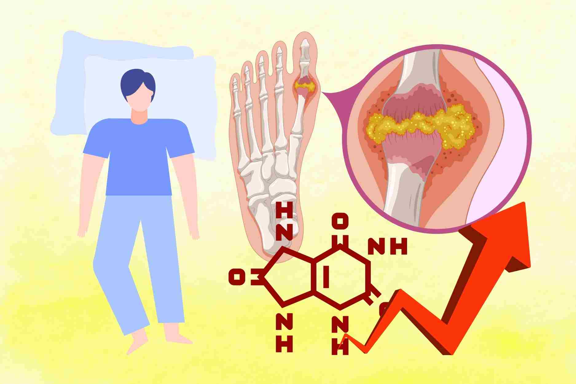 Hora dorada para dormir para personas con alto acido urico. Grafico: Dinh Dinh
