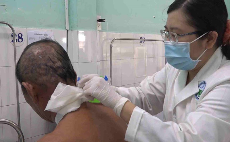 Infection is severe because the shingles is self-treated by covering the leaves of trees and going to a spa. Photo: Thanh Chan