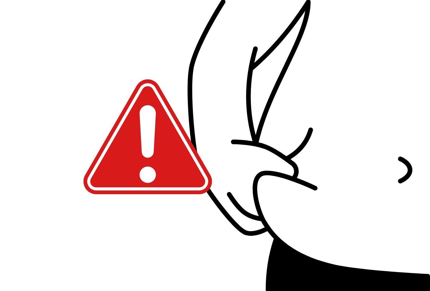 Un caso de pacientes sufrio complicaciones graves despues de realizar una cirugia de liposuccion abdominal del Hospital General GIA Dinh. Grafico: Thanh Thanh