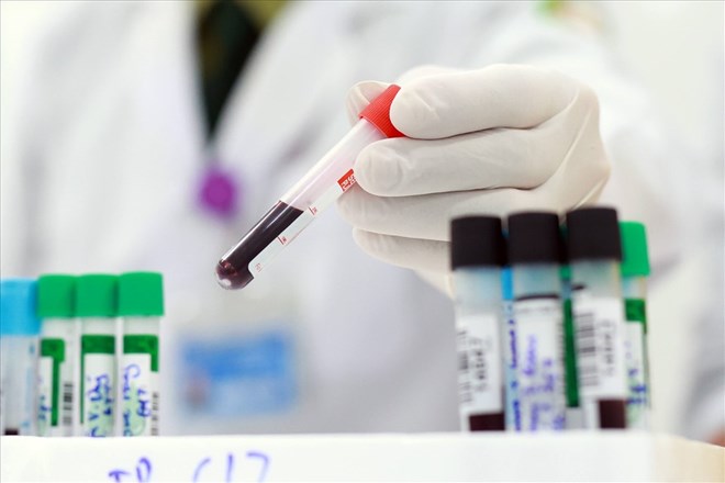 Pruebas Covid-19. Foto: Hai Nguyen