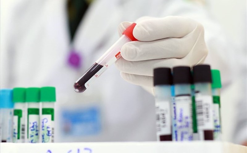 COVID-19 test. Photo: Hai Nguyen