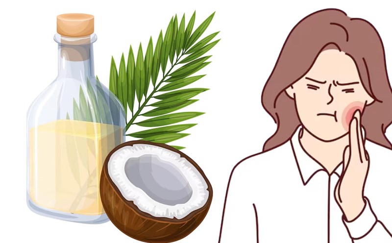 Benefits of coconut oil for gingivitis. Graphics: Thien Nhan