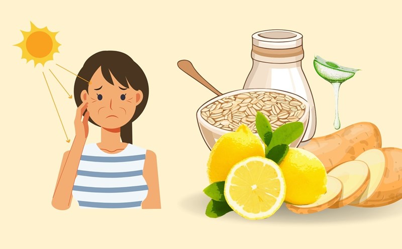 Prevent sunburn at home with 5 extremely effective natural therapies. Graphics: Dinh Dinh