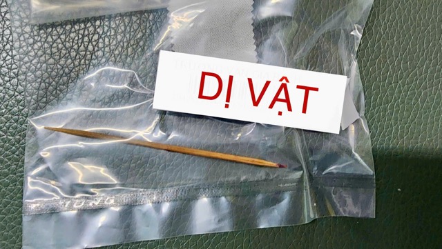 El objeto es un palillo de dientes que perforo los dientes del duodeno que el cirujano quito. Foto: El hospital proporciona