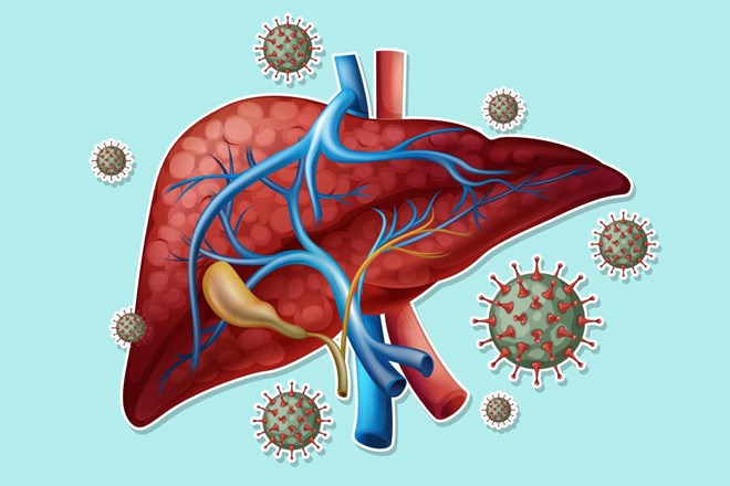 Un higado dañado no hablo temprano. Cuando el cuerpo señala claramente, es probable que haya tocado el umbral de cirrosis, lo cual es dificil de recuperar. Graficos: Thien Nhan