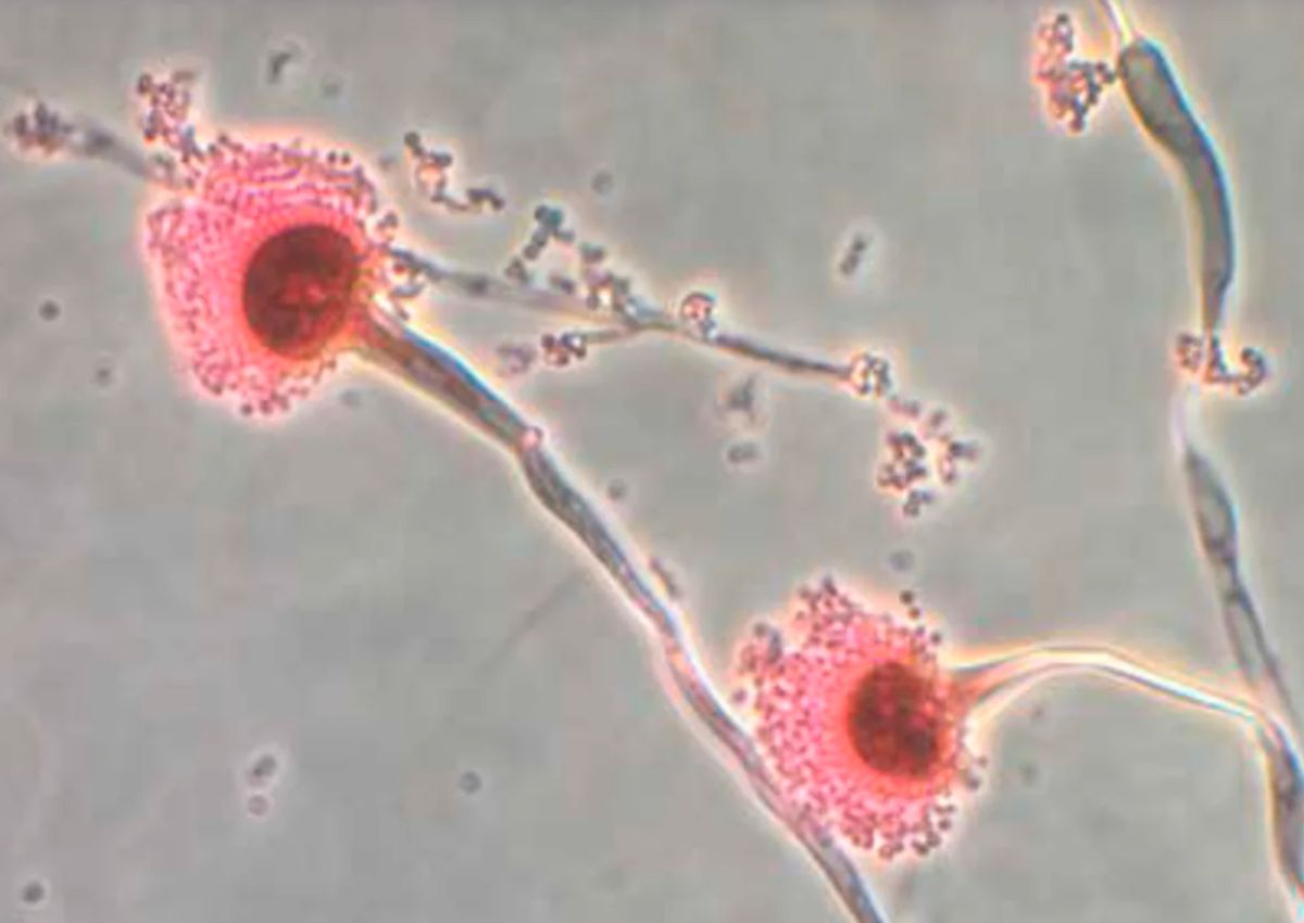 Los hongos Aspergillus estan expandiendo el alcance de la actividad cuando el mundo se calienta. Foto: Centro de control y prevencion (CDC)