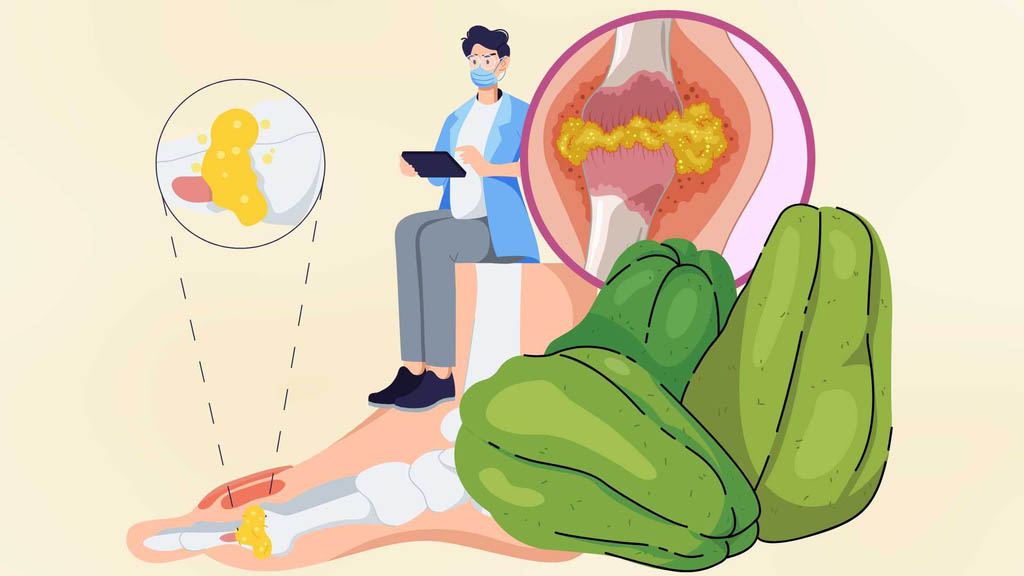 Digales como comer seguridad de caucho para personas con alto acido urico. Grafico: Dinh Dinh