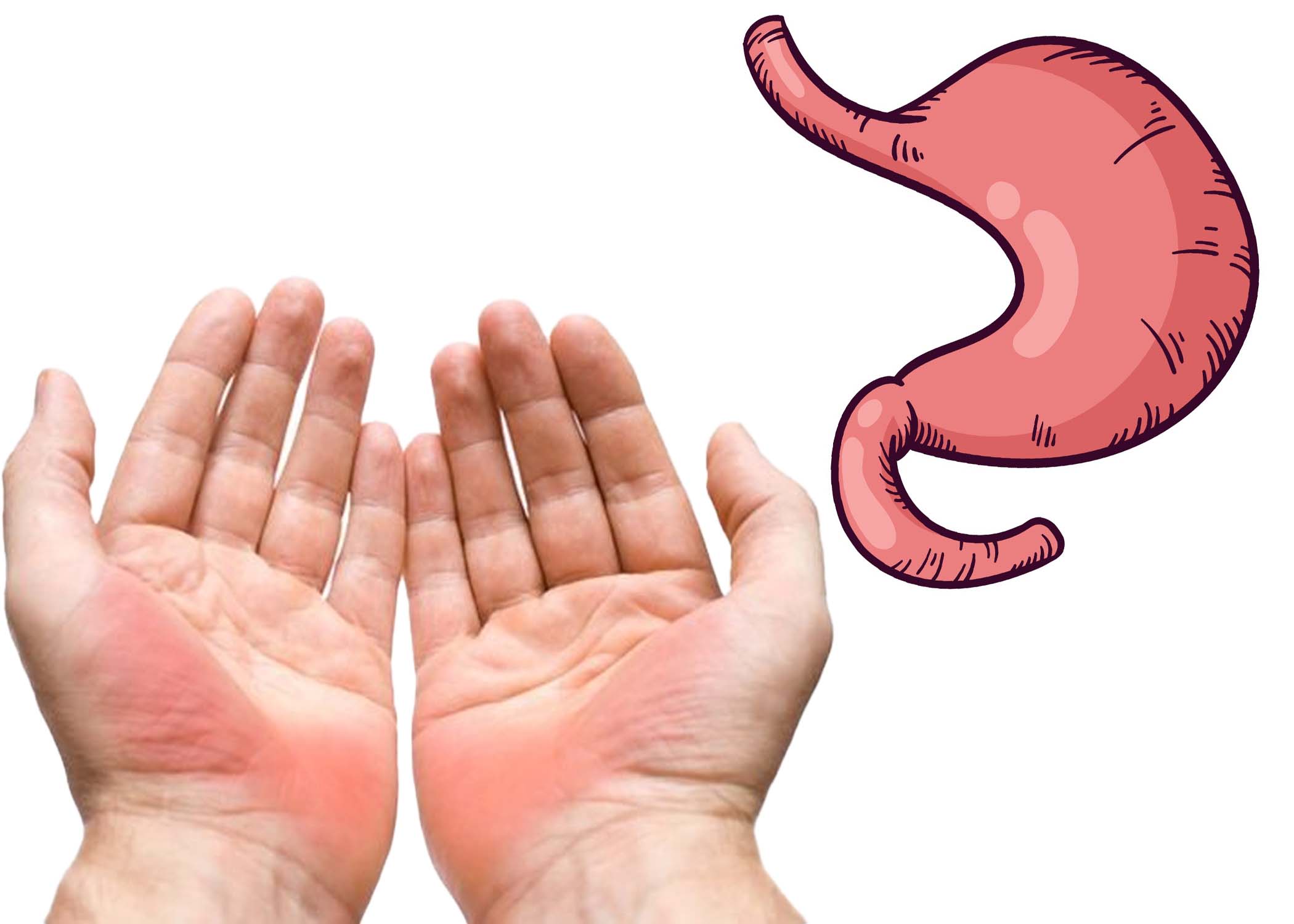 Las manos frias o las manos calidas no solo afectan la sensacion, sino que tambien estan relacionadas con la funcion intestinal, la circulacion sanguinea y el equilibrio hormonal corporal. Graficos: Cat Tien