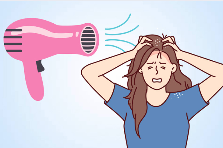 Regular hair drying habits can cause dandruff. Graphics: Duc Thien
