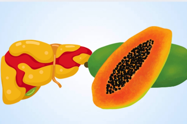 Fatty liver nen an qua nay