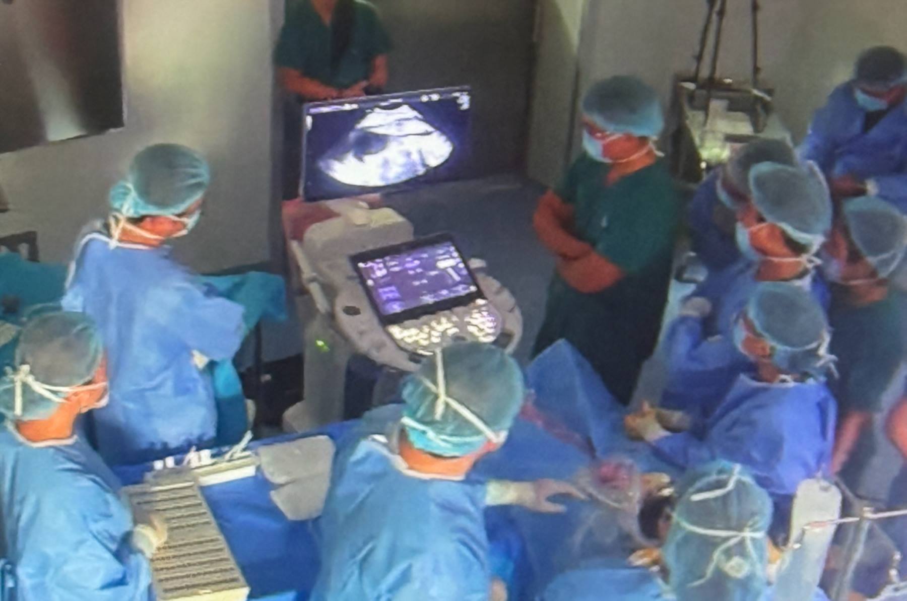 Experts from Tu Du Hospital and Children's Hospital 1 successfully performed fetal heart intervention for a Singaporean mother. Photo: Provided by the Ho Chi Minh City Department of Health