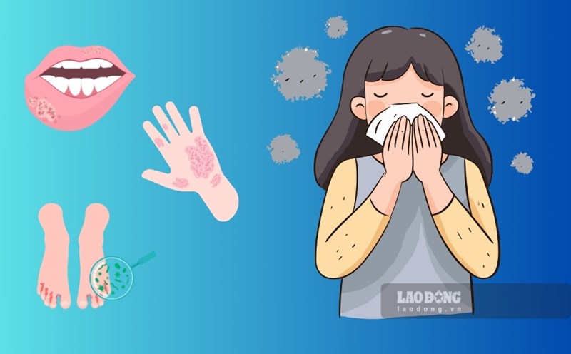 Up to now, Binh Dinh has recorded 192 cases of hand, foot and mouth disease and 6 outbreaks. Graphics: Hoai Luan